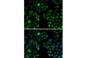 Immunofluorescence analysis of U2OS cells using EPC1 antibody (ABIN6133506, ABIN6140203, ABIN6140204 and ABIN6221494). (EPC1 Antikörper  (AA 1-300))