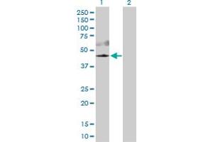 Western Blot analysis of AKT3 expression in transfected 293T cell line by AKT3 MaxPab polyclonal antibody. (AKT3 Antikörper  (AA 1-479))