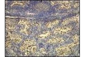 Immunohistochemistry (IHC) image for anti-Transcription Termination Factor, RNA Polymerase I (TTF1) (N-Term) antibody (ABIN870522) (TTF1 Antikörper  (N-Term))