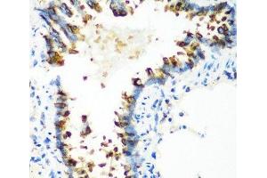 Immunohistochemistry of paraffin-embedded Rat lung using MTCO2 Polyclonal Antibody at dilution of 1:100 (40x lens). (COX2 Antikörper)