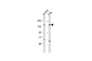 All lanes : Anti-CACNA1F Antibody (Center) at 1:2000 dilution Lane 1: A-673 whole cell lysate Lane 2: Y79 whole cell lysate Lysates/proteins at 20 μg per lane.