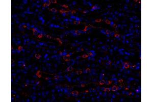 Immunohistochemistry (IHC) image for anti-Early Endosome Antigen 1 (EEA1) (AA 2-13) antibody (ABIN1742484)