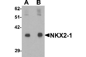 Western blot analysis of NKX2-1 in rat lung tissue lysate with NKX2-1 antibody at (A) 1 and (B) 2 µg/mL. (NKX2-1 Antikörper  (N-Term))