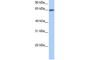 WB Suggested Anti-ZNF449 Antibody Titration:  0. (ZNF449 Antikörper  (N-Term))