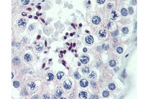 Immunohistochemistry (IHC) image for anti-PR Domain Containing 9 (PRDM9) (Middle Region) antibody (ABIN2774963)