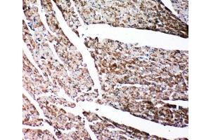 Immunohistochemistry (IHC) image for anti-Gelsolin (GSN) (AA 763-775) antibody (ABIN3031036)