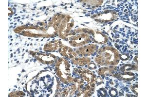 HDAC9 antibody was used for immunohistochemistry at a concentration of 2. (HDAC9 Antikörper  (C-Term))