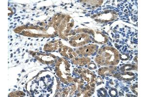 HDAC9 antibody was used for immunohistochemistry at a concentration of 2. (HDAC9 Antikörper  (C-Term))