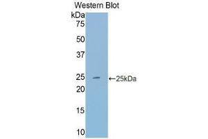 Western Blotting (WB) image for anti-Transferrin (TF) (AA 22-176) antibody (ABIN1860868)