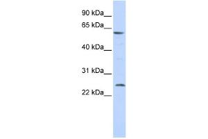 anti-Solute Carrier Family 18 (Vesicular Monoamine Transporter), Member 1 (SLC18A1) (Middle Region) antibody