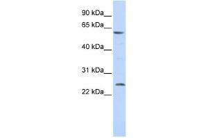 WB Suggested Anti-SLC18A1 Antibody Titration:  0. (SLC18A1 Antikörper  (Middle Region))