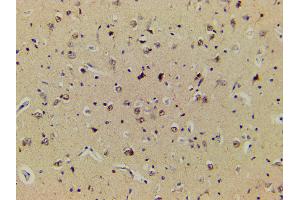Immunohistochemistry (IHC) image for anti-LIM Domain Kinase 1 (LIMK1) (pThr508) antibody (ABIN6255701)