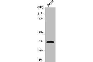 Western Blot analysis of Jurkat cells using Cleaved-Cathepsin A 32k (R326) Polyclonal Antibody (CTSA Antikörper  (Cleaved-Arg326))