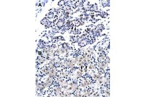 Immunohistochemical staining (Formalin-fixed paraffin-embedded sections) of human pancreas (A) and human liver (B) with CDX4 polyclonal antibody  at 4-8 ug/mL working concentration. (CDX4 Antikörper  (C-Term))
