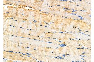 ABIN6264868 and ABIN6277492 at 1/100 staining Rat muscle tissue by IHC-P. (RRM2 Antikörper  (C-Term))