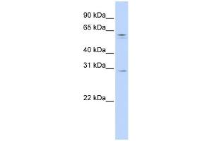 WB Suggested Anti-REC8 Antibody Titration:  0.