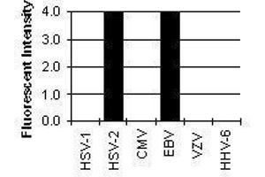 Cross Reactivity Results determined by IFA (HSV-2 gE Antikörper)
