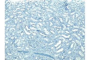 (ABIN184697) Negative Control showing staining of paraffin embedded Human Kidney, with no primary antibody. (STUB1 Antikörper  (C-Term))