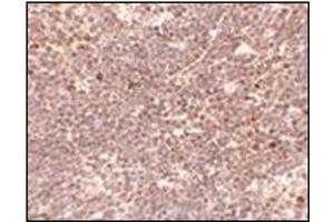 Immunohistochemistry of S1P1 in Mouse thymus tissue with EDG-1 / S1PR1 antibody at 5 μg/ml. (S1PR1 Antikörper  (C-Term))