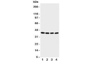 Western blot testing of EIF2B antibody and Lane 1:  M451;  2: Jurkat;  3: HeLa;  4: 293T cell lysate. (EIF2S2 Antikörper  (C-Term))
