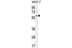 AKT1 Antibody (pT450) western blot analysis in MCF-7 cell line lysates (35 µg/lane). (AKT1 Antikörper  (C-Term))