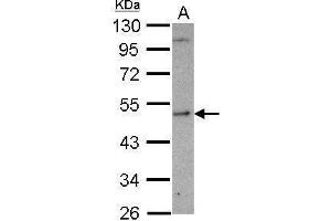 WB Image Sample (30 ug of whole cell lysate) A: U87-MG 10% SDS PAGE antibody diluted at 1:1000 (SHMT1 Antikörper)