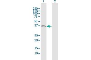 Western Blotting (WB) image for anti-Activin A Receptor, Type IIB (ACVR2B) (AA 1-303) antibody (ABIN513102)
