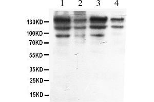 Western blot analysis of ADAR1 expression in HELA whole cell lysates ( Lane 1), A549 whole cell lysates ( Lane 2), MCF-7 whole cell lysates ( Lane 3) and HEPG2 whole cell lysates ( Lane 4).