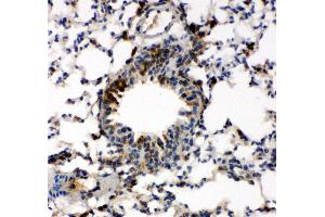 Immunohistochemistry (IHC) image for anti-Caspase 6, Apoptosis-Related Cysteine Peptidase (CASP6) (AA 24-44), (N-Term) antibody (ABIN3043219)