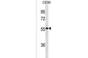 lgA Antibody (Center)(Ascites) ABIN1882260 western blot analysis in CEM cell line lysates (35 μg/lane). (GLS2 Antikörper  (AA 150-178))