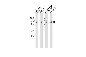 Western blot analysis of lysates from HT-29, PC-3, U-87 MG cell line and human testis tissue lysate(from left to right), using OASL Antibody  (ABIN390168 and ABIN2840664).