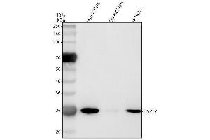 Immunoprecipitating HSP27 in Hela whole cell lysate.