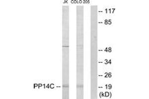 Western blot analysis of extracts from Jurkat/COLO205 cells, using PPP1R14C Antibody. (PPP1R14C Antikörper  (AA 51-100))