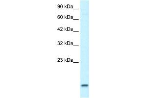 WB Suggested Anti-UBE2N Antibody Titration:  1. (UBE2N Antikörper  (Middle Region))