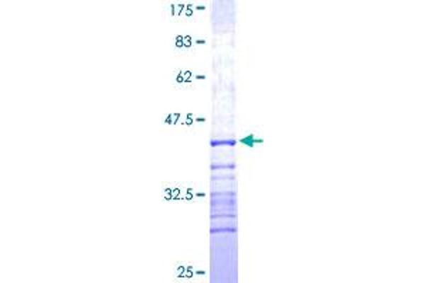 CTNNA1 Protein (AA 152-250) (GST tag)