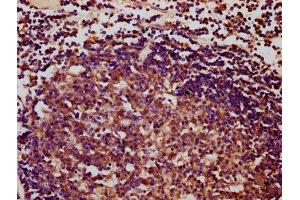 IHC image of ABIN7166787 diluted at 1:400 and staining in paraffin-embedded human lymph node tissue performed on a Leica BondTM system. (IBA57 Antikörper  (AA 286-356))