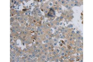Immunohistochemistry (IHC) image for anti-Creatine Kinase, Mitochondrial 1A (CKMT1A) antibody (ABIN5546002) (CKMT1A Antikörper)