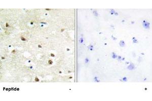 Immunohistochemistry analysis of paraffin-embedded human brain tissue using HNRNPC polyclonal antibody . (HNRNPC Antikörper)