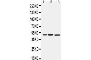 Anti-IRF8 antibody, Western blotting Lane 1: RAJI Cell Lysate Lane 2: Rat Liver Tissue Lysate Lane 3: Rat Kidney Tissue Lysate (IRF8 Antikörper  (C-Term))