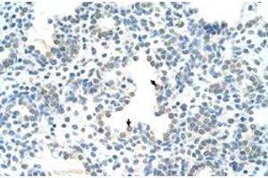 Immunohistochemical staining (Formalin-fixed paraffin-embedded sections) of human lung with HOXC10 polyclonal antibody  at 4-8 ug/mL working concentration. (HOXC10 Antikörper  (N-Term))