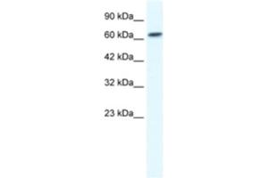 Western Blotting (WB) image for anti-gamma-aminobutyric Acid (GABA) A Receptor, beta 2 (GABRB2) antibody (ABIN2461130) (GABRB2 Antikörper)