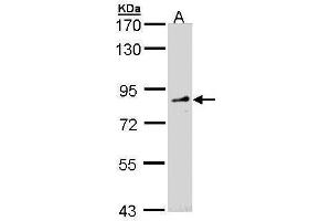 WB Image Sample (30 ug of whole cell lysate) A: Molt-4 , 7. (FGD4 Antikörper)