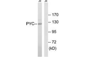 Western blot analysis of extracts from Jurkat cells, using PC Antibody. (PC (AA 357-406) Antikörper)