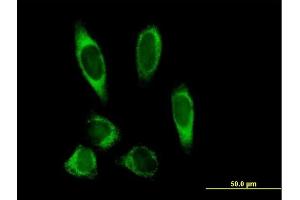 Immunofluorescence of purified MaxPab antibody to PLOD2 on HeLa cell.