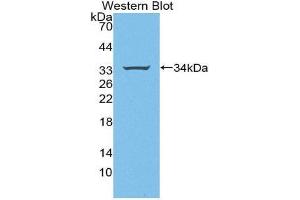 Western Blotting (WB) image for anti-Signal Transducing Adaptor Molecule (SH3 Domain and ITAM Motif) 1 (STAM) (AA 196-465) antibody (ABIN3206391) (STAM Antikörper  (AA 196-465))