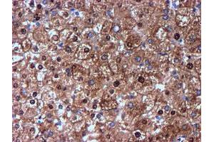 Immunohistochemical staining of paraffin-embedded Human liver tissue using anti-NNMT mouse monoclonal antibody. (NNMT Antikörper)