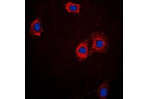 Immunofluorescent analysis of cTnI staining in A431 cells. (TNNI3 Antikörper  (Center))