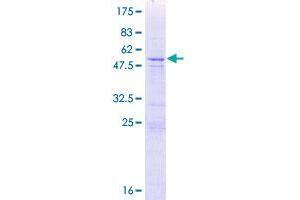 Chromosome X Open Reading Frame 48 (CXorf48) (AA 1-264) protein (GST tag)
