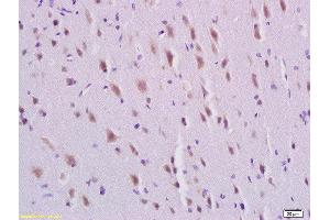 Formalin-fixed and paraffin embedded rat brain labeled with Rabbit Anti-PDGFBB Polyclonal Antibody, Unconjugated  at 1:200 followed by conjugation to the secondary antibody and DAB staining (PDGF-BB Homodimer (AA 151-241) Antikörper)