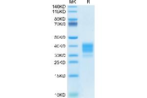 Mouse Fc gamma RIV/CD16-2 on Tris-Bis PAGE under reduced condition.